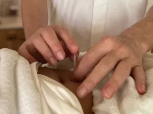 Acupuncture treatment